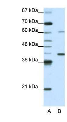 Western Blot: ZNF843 Antibody [NBP1-91549] - HepG2 cell lysate, concentration 0.2-1 ug/ml.