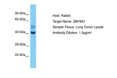Western Blot: ZNF843 Antibody [NBP2-88620] - Host: Rabbit. Target Name: ZNF843. Sample Type: Lung Tumor lysates. Antibody Dilution: 1.0ug/ml