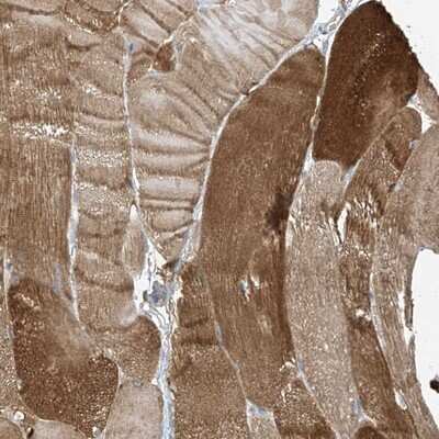 Immunohistochemistry-Paraffin: ZNF846 Antibody [NBP1-90914] - Staining of human skeletal muscle shows moderate cytoplasmic positivity in myocytes.