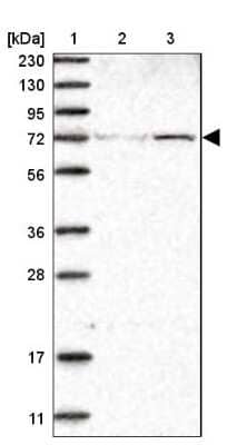 Western Blot: ZNF846 Antibody [NBP1-90914] - Lane 1: Marker  [kDa] 230, 130, 95, 72, 56, 36, 28, 17, 11.  Lane 2: Human cell line RT-4.  Lane 3: Human cell line U-251MG sp