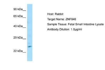 Western Blot: ZNF846 Antibody [NBP2-86558] - Host: Rabbit. Target Name: ZNF846. Sample Type: Fetal Small Intestine lysates. Antibody Dilution: 1.0ug/ml