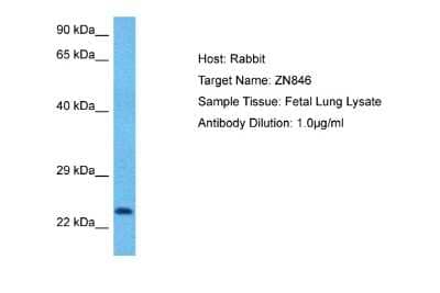 Western Blot: ZNF846 Antibody [NBP2-86559] - WB Suggested Anti-ZN846 antibody Titration: 1 ug/mL. Sample Type: Human Fetal Lung