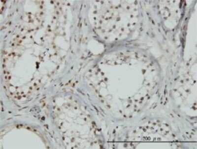 Immunohistochemistry-Paraffin ZNF85 Antibody (2G9) - Azide and BSA Free