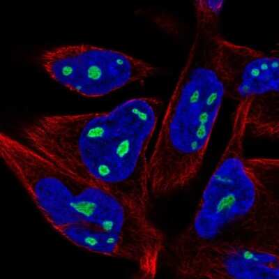 Immunocytochemistry/Immunofluorescence: ZNF853 Antibody [NBP2-49527] - Immunofluorescent staining of human cell line RH-30 shows localization to nucleoli.