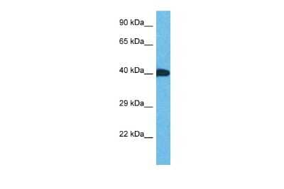 Western Blot ZNF883 Antibody - BSA Free