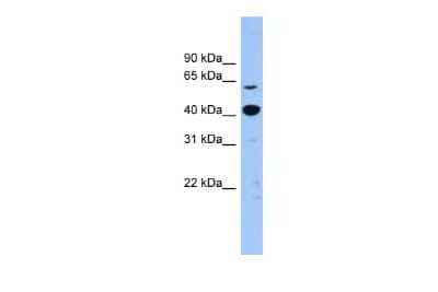 Western Blot: ZNF883 Antibody [NBP3-09289] - Western blot analysis of ZNF883 in Human brain as a positive control. Antibody dilution at 0.2-1 ug/ml