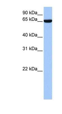 Western Blot: ZNF891 Antibody [NBP1-91383] - Hela cell lysate, concentration 0.2-1 ug/ml.