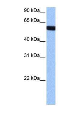 Western Blot: ZNF891 Antibody [NBP1-91384] - HepG2 cell lysate, concentration 0.2-1 ug/ml.