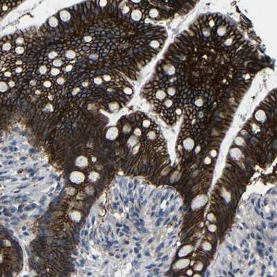 Immunohistochemistry-Paraffin: ZNF90 Antibody [NBP1-93683] - Staining of human colon shows strong cytoplasmic and membranous positivity in glandular cells.