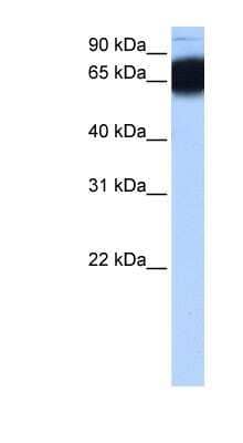 Western Blot: ZNF90 Antibody [NBP1-91427] - Human Heart lysate, concentration 0.2-1 ug/ml.