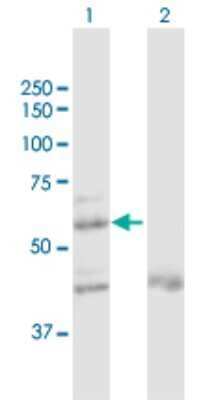 Western Blot: ZNF92 Antibody [H00168374-D01P] - Analysis of ZNF92 expression in transfected 293T cell line by ZNF92 polyclonal antibody.Lane 1: ZNF92 transfected lysate(60.20 KDa).Lane 2: Non-transfected lysate.