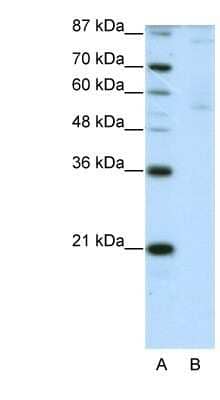 Western Blot: ZNF92 Antibody [NBP1-80415] - HepG2 cell lysate, concentration 2.5 ug/ml.