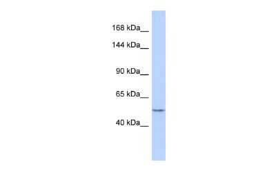 Western Blot: ZNF92 Antibody [NBP2-82384] - Host: Rabbit. Target Name: ZNF92. Sample Type: Fetal Brain lysates. Antibody Dilution: 1.0ug/ml