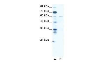 Western Blot: ZNF92 Antibody [NBP2-82385] - WB Suggested Anti-ZNF92 Antibody Titration: 2.5ug/ml. ELISA Titer: 1:62500. Positive Control: Jurkat cell lysate