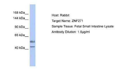 Western Blot ZNF93 Antibody - BSA Free