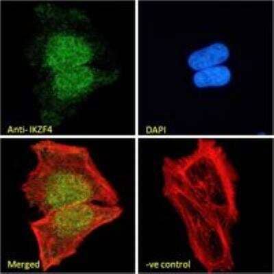 Immunocytochemistry/Immunofluorescence: ZNFN1A4 Antibody [NBP3-12160] - Immunofluorescence analysis of paraformaldehyde fixed HeLa cells, permeabilized with 0.15% Triton. Primary incubation 1hr (10ug/ml) followed by Alexa Fluor 488 secondary antibody (2ug/ml), showing nuclear staining. Actin filaments were stained with phalloidin (red) and the nuclear stain is DAPI (blue). Negative control: Unimmunized goat IgG (10ug/ml) followed by Alexa Fluor 488 secondary antibody (2ug/ml).