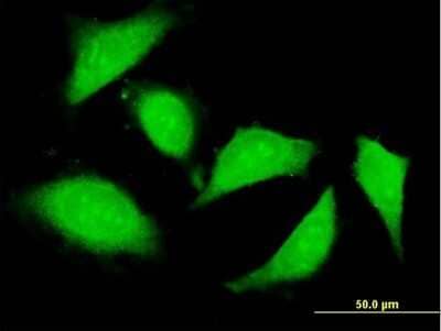 Immunocytochemistry/Immunofluorescence: ZNFX1 Antibody [H00057169-B01P] - Analysis of purified antibody to ZNFX1 on HeLa cell. (antibody concentration 10 ug/ml)