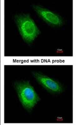 Immunocytochemistry/Immunofluorescence: ZNHIT1 Antibody [NBP1-33372] - Paraformaldehyde-fixed HeLa, using antibody at 1:100 dilution.