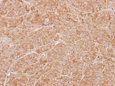 Immunohistochemistry-Paraffin: ZNHIT1 Antibody [NBP1-33372] - Paraffin-embedded SW480 xenograft, using antibody at 1:500 dilution.