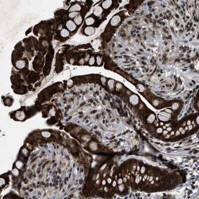 Immunohistochemistry-Paraffin: ZNHIT1 Antibody [NBP1-85673] - Staining of human colon shows strong cytoplasmic and nuclear positivity in glandular cells.