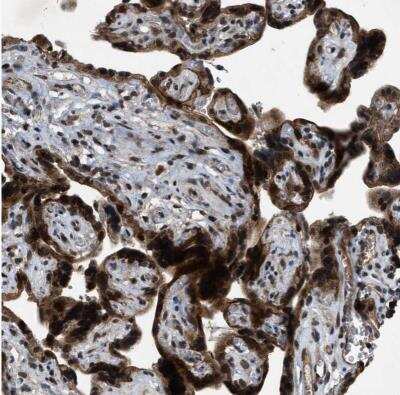 Immunohistochemistry-Paraffin: ZNHIT1 Antibody [NBP1-85673] - Staining of human placenta shows strong positivity in trophoblastic cells.