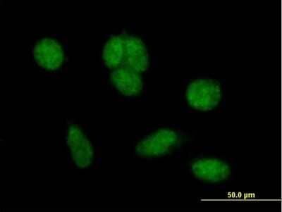 Immunocytochemistry/ Immunofluorescence ZNHIT6 Antibody - Azide and BSA Free