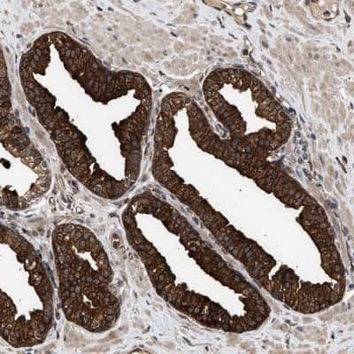 Immunohistochemistry-Paraffin ZNHIT6 Antibody