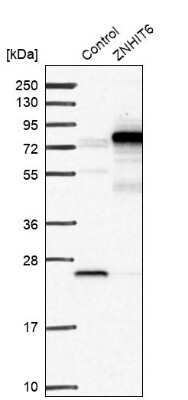 Western Blot ZNHIT6 Antibody