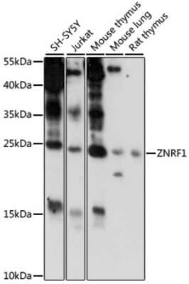 Western Blot: ZNRF1 Antibody [NBP2-94411] - Analysis of extracts of various cell lines, using ZNRF1 at 1000 dilution. Secondary antibody: HRP Goat Anti-Rabbit IgG (H+L) at 1:10000 dilution. Lysates/proteins: 25ug per lane. Blocking buffer: 3% nonfat dry milk in TBST. Detection: ECL Basic Kit . Exposure time: 90s.