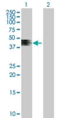 Western Blot ZNRF4 Antibody - Azide and BSA Free