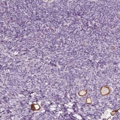 Immunohistochemistry-Paraffin ZP4 Antibody