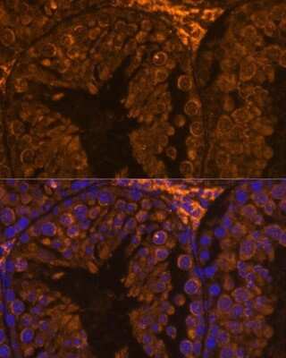 Immunohistochemistry ZPBP Antibody - Azide and BSA Free