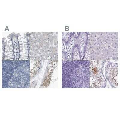 Immunohistochemistry-Paraffin: ZPBP2 Antibody [NBP1-82689] - Staining of human colon, liver, lymph node and testis using Anti-ZPBP2 antibody NBP1-82689 (A) shows similar protein distribution across tissues to independent antibody NBP2-33671 (B).