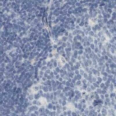 Immunohistochemistry-Paraffin: ZPBP2 Antibody [NBP1-82689] - Staining of human lymph node.