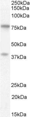 Unknown ZRANB1/Trabid Antibody