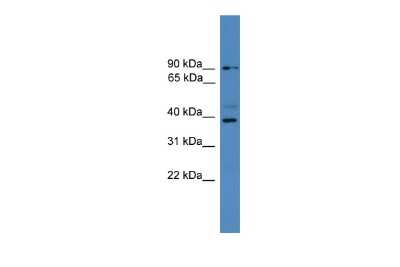 Western Blot: ZRANB1/Trabid Antibody [NBP3-09380] - Western blot analysis using NBP3-09380 on Human 721_B as a positive control. Antibody Titration: 0.2-1 ug/ml