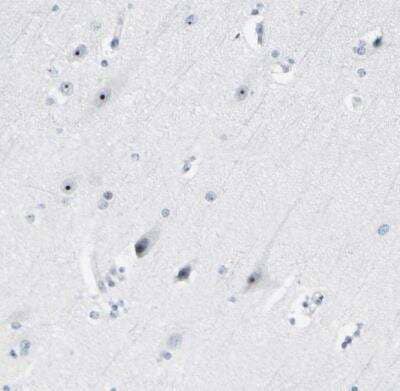 Immunohistochemistry-Paraffin ZSCAN1 Antibody - BSA Free