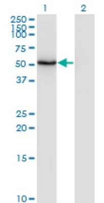 Western Blot: ZSCAN21/ZFP38 Antibody (4B11) [H00007589-M08] - Analysis of ZSCAN21 expression in transfected 293T cell line by ZNF38 monoclonal antibody (M08), clone 4B11. Lane 1: ZSCAN21 transfected lysate (Predicted MW: 53.7 KDa). Lane 2: Non-transfected lysate.