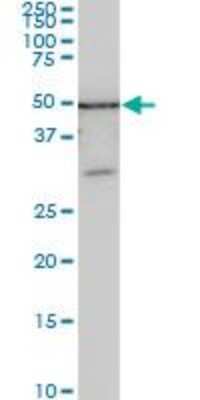 Western Blot: ZSCAN21/ZFP38 Antibody (4B3) [H00007589-M09] - ZNF38 monoclonal antibody (M09), clone 4B3. Western Blot analysis of ZNF38 expression in SJCRH30 ( Cat # L027V1 ).