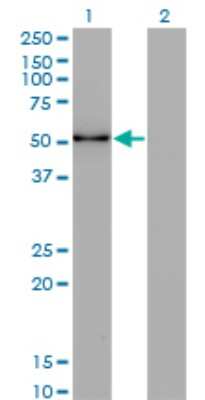 Western Blot: ZSCAN21/ZFP38 Antibody (4F10) [H00007589-M16] - Analysis of ZSCAN21 expression in transfected 293T cell line by ZNF38 monoclonal antibody (M16), clone 4F10. Lane 1: ZSCAN21 transfected lysatE (50.9 KDa). Lane 2: Non-transfected lysate.