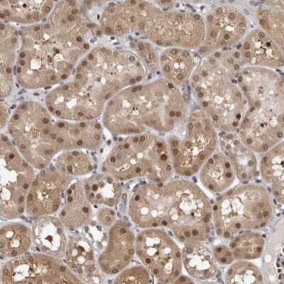 Immunohistochemistry-Paraffin: ZSCAN21/ZFP38 Antibody [NBP1-84182] - Staining of human kidney shows moderate cytoplasmic and nuclear positivity in tubule cells.