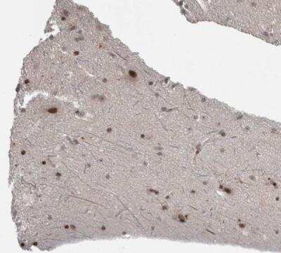 Immunohistochemistry-Paraffin: ZSCAN21/ZFP38 Antibody [NBP1-84182] - Staining of human cerebral cortex shows strong nuclear positivity in neurons.