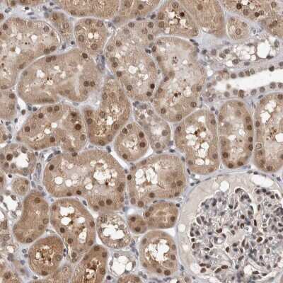 Immunohistochemistry-Paraffin: ZSCAN21/ZFP38 Antibody [NBP1-84182] - Staining of human kidney shows moderate to strong nuclear positivity in cells in tubules.