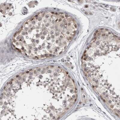 Immunohistochemistry-Paraffin ZSCAN21/ZFP38 Antibody