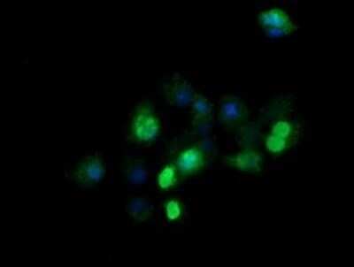 Immunocytochemistry/Immunofluorescence: ZSCAN21/ZFP38 Antibody (OTI2E5) - Azide and BSA Free [NBP2-74956] - Analysis of COS7 cells transiently transfected by pCMV6-ENTRY ZSCAN21.