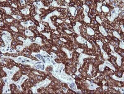 Immunohistochemistry: ZSCAN21/ZFP38 Antibody (OTI2E5) - Azide and BSA Free [NBP2-74956] - Analysis of Human liver tissue. (Heat-induced epitope retrieval by 10mM citric buffer, pH6.0, 120C for 3min)