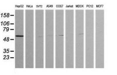 Western Blot: ZSCAN21/ZFP38 Antibody (OTI2E5) - Azide and BSA Free [NBP2-74956] - Analysis of extracts (35ug) from 9 different cell lines (HepG2: human; HeLa: human; SVT2: mouse; A549: human; COS7: monkey; Jurkat: human; MDCK: canine; PC12: rat; MCF7: human).