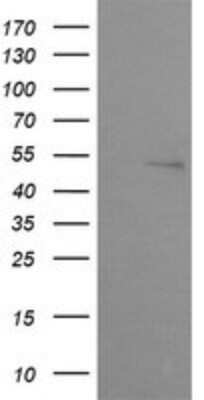 Western Blot: ZSCAN21/ZFP38 Antibody (OTI2E5) - Azide and BSA Free [NBP2-74956] - Analysis of HEK293T cells were transfected with the pCMV6-ENTRY control (Left lane) or pCMV6-ENTRY ZSCAN21.