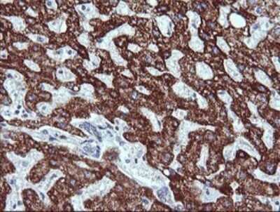 Immunohistochemistry: ZSCAN21/ZFP38 Antibody (OTI2E5) [NBP2-45443] - Analysis of Human liver tissue. (Heat-induced epitope retrieval by 10mM citric buffer, pH6.0, 120C for 3min)