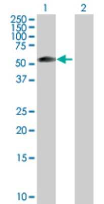 Western Blot: ZSCAN21/ZFP38 Antibody [H00007589-D01P] - Analysis of ZSCAN21 expression in transfected 293T cell line by ZSCAN21 polyclonal antibody.Lane 1: ZSCAN21 transfected lysate(53.70 KDa).Lane 2: Non-transfected lysate.